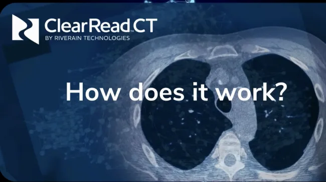 ClearRead CT Demo