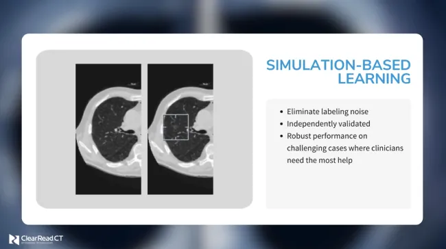 Simulated Data for Improved Nodule Detection