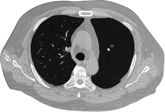 ClearRead CT