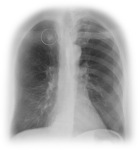 ClearRead Xray