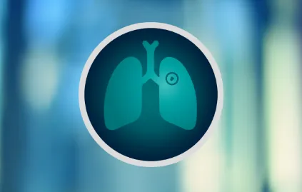 Lung Cancer Resources